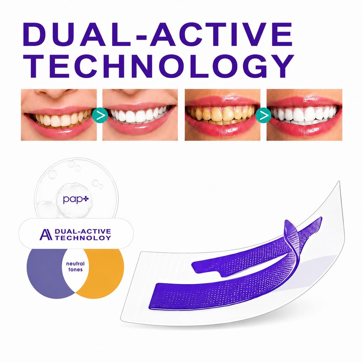 Aura Smile™ Purple Teeth Whitening Strips